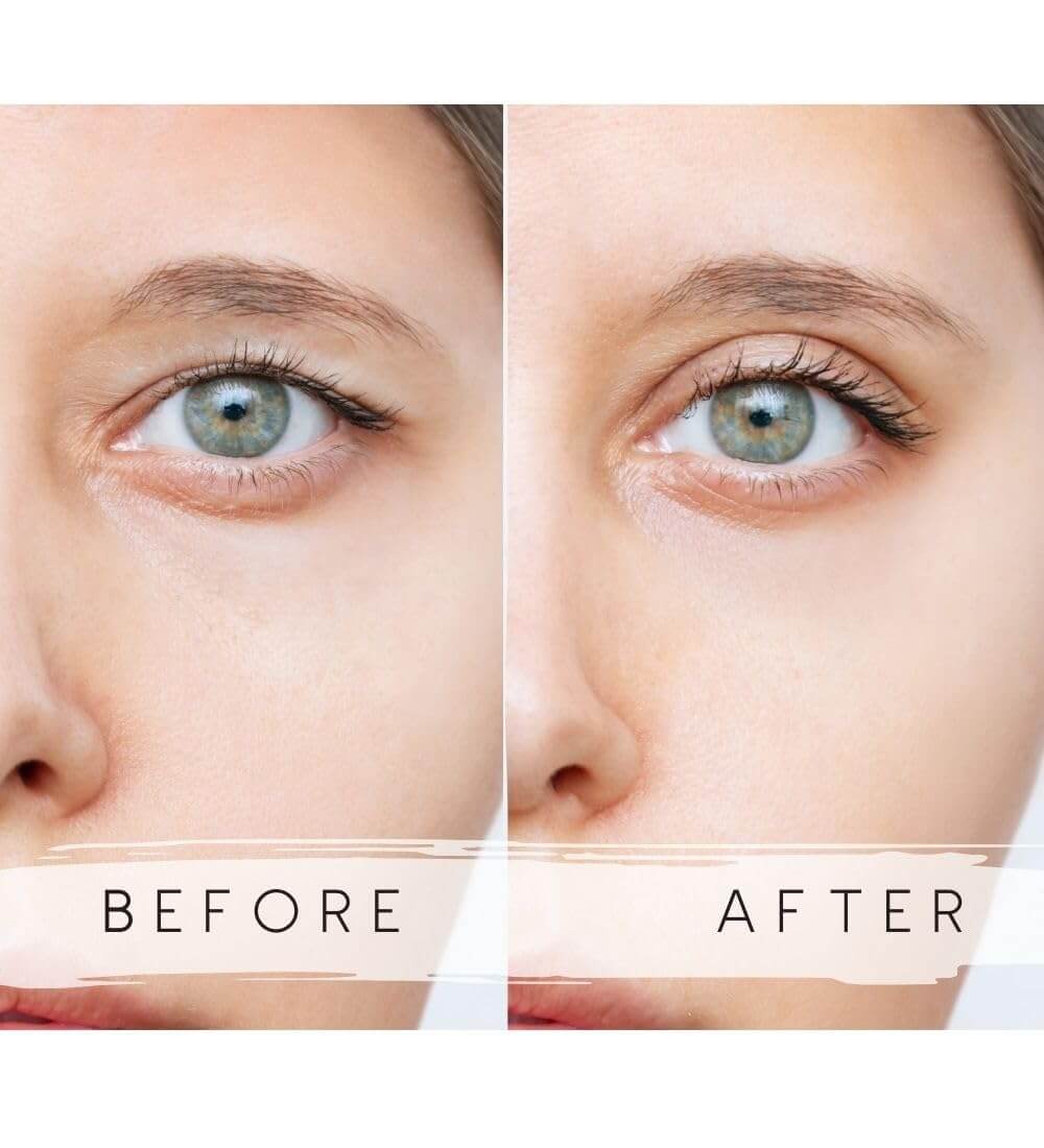 Schlupflider Tape Erfahrungen: Ein Blick auf WUNDERTAPE Schlupflid Stripes