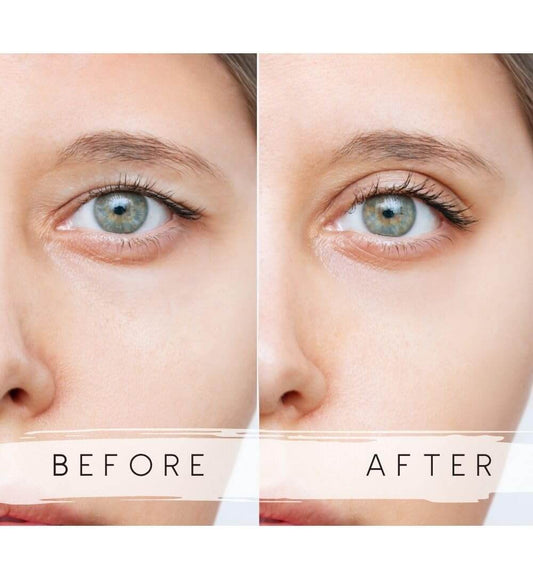 Schlupflider Tape Erfahrungen: Ein Blick auf WUNDERTAPE Schlupflid Stripes