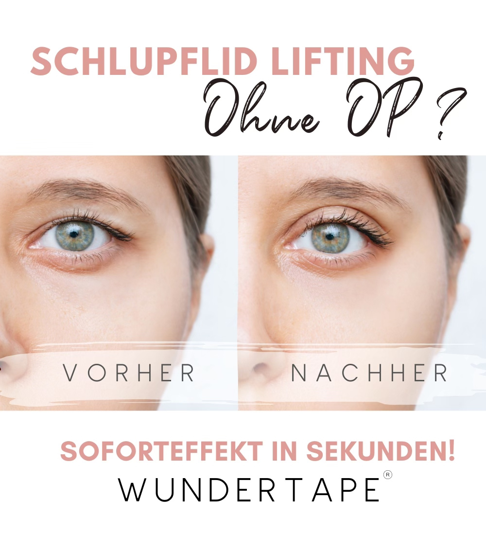 wundertape schlupflid streifen