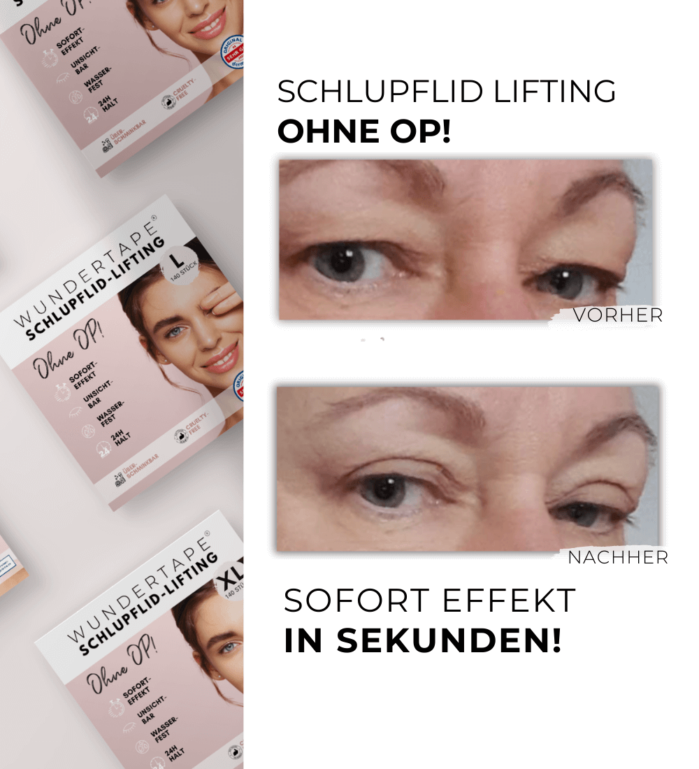 WUNDERTAPE (Probepackung) Schlupflider Stripes "M+L+XL" - Wundertape