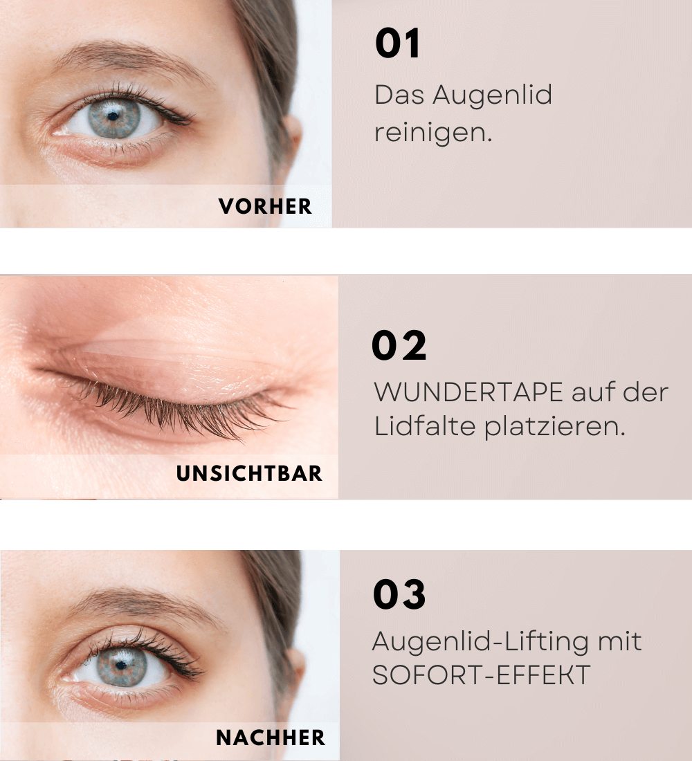 WUNDERTAPE Schlupflider Stripes "L" - Wundertape