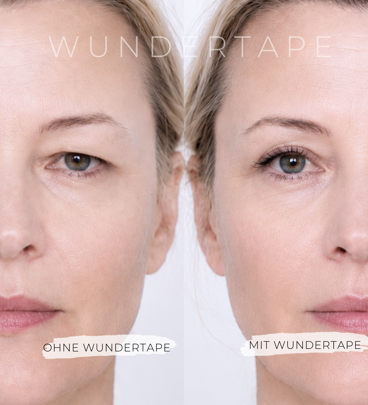 WUNDERTAPE Schlupflider Tape (Probepackung) "M+L+XL"