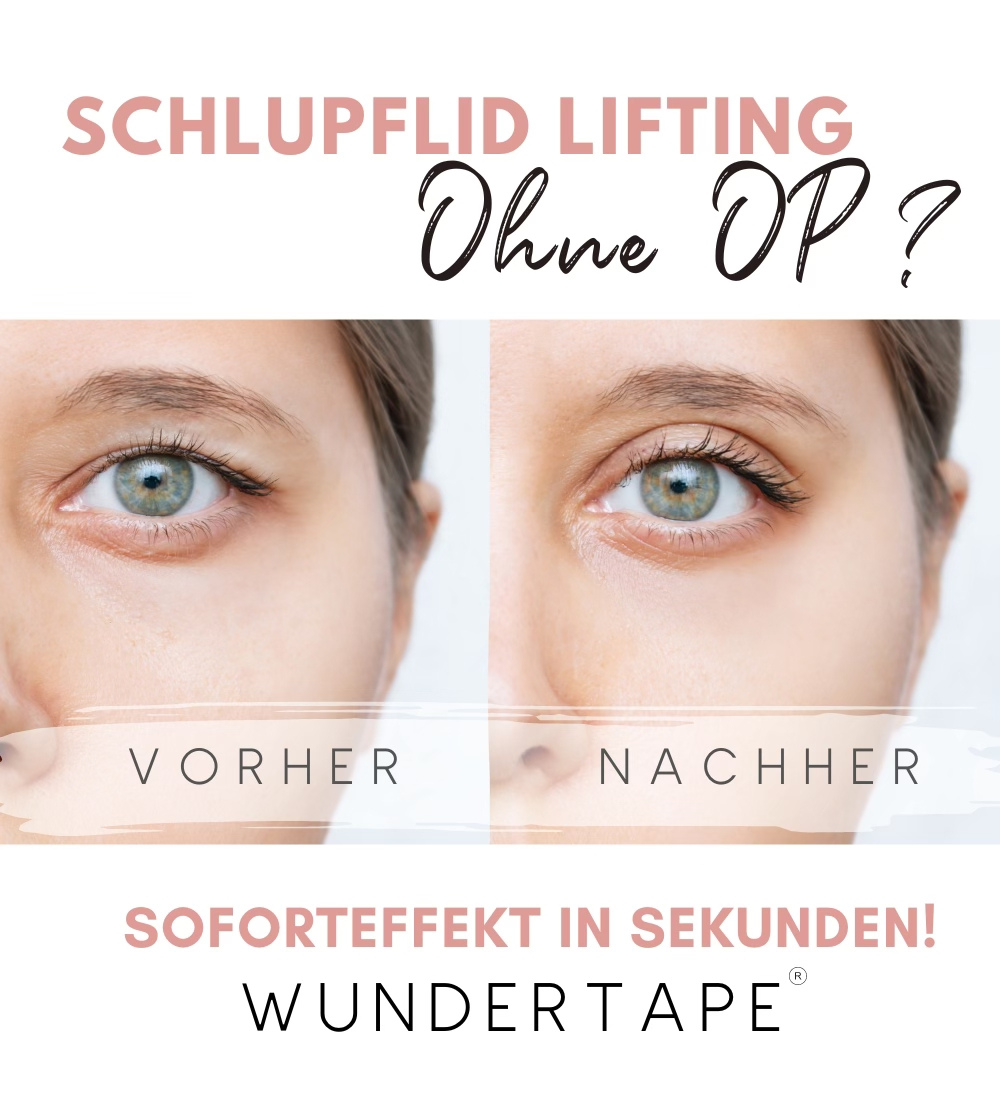 WUNDERTAPE | Schlupflid Augen-Lifting mit SOFORT Effekt ohne OP!