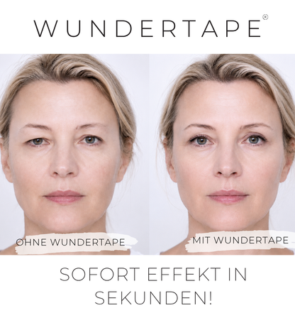 WUNDERTAPE Schlupflider Stripes "L"